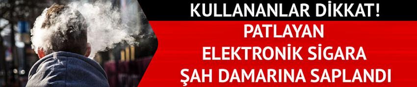 Patlayan elektronik sigaranın parçası şah damarına saplandı