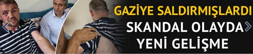 Gazinin kafede darbedilmesi ile ilgili yeni gelişme