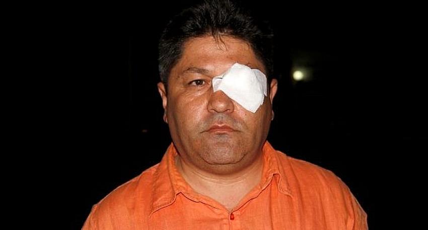 Muğla'da gazetecinin darbedildi